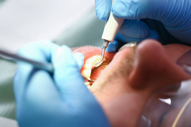 Best Emergency Treatment for Oral Infections in Cheat Lake, WV